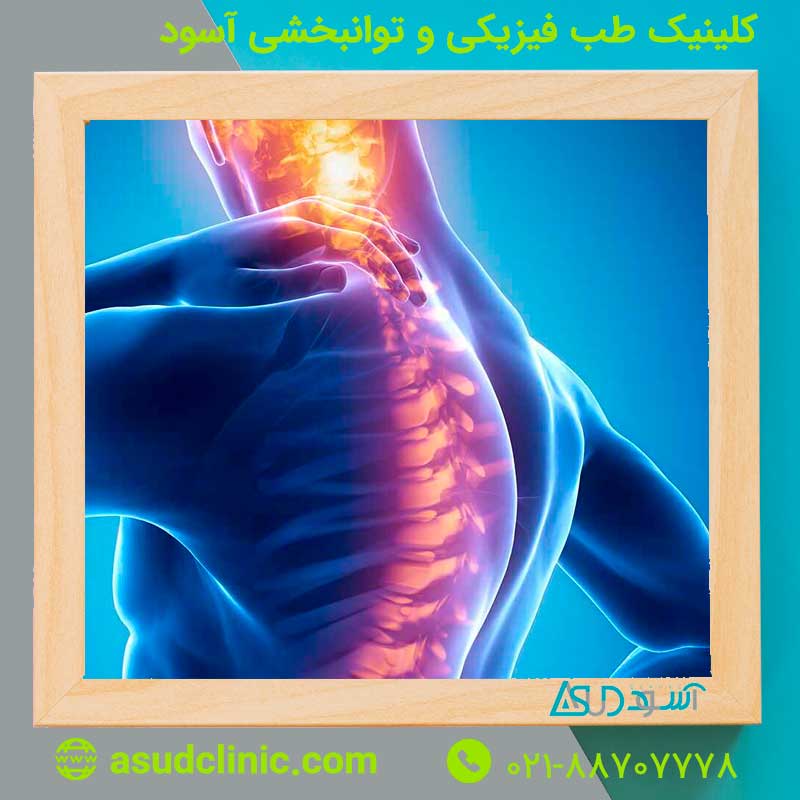 فتق دیسک گردن